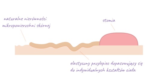 Worek urostomijny jednoczęściowy Aurega® 1 Convex Light Worek urostomijny jednoczęściowy Aurega® 1 Convex Light