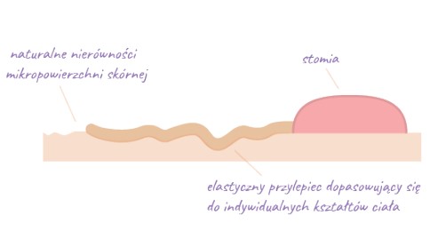 Worek urostomijny pediatryczny jednoczęściowy Aurega® 1