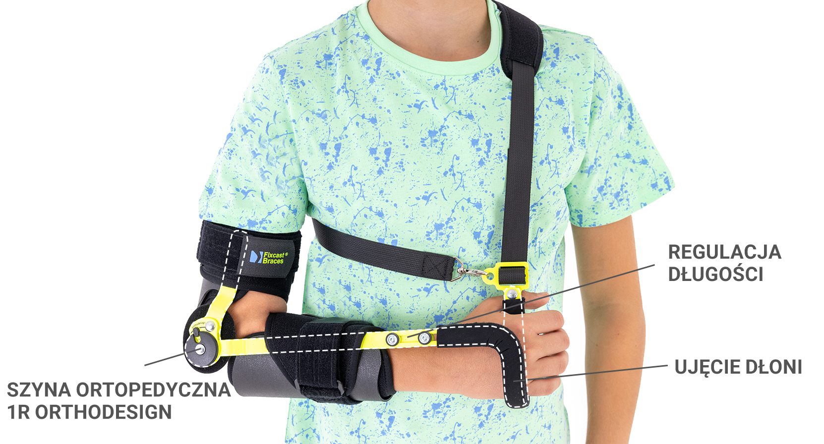 Pediatryczna orteza łokcia z ujęciem dłoni FIX-KG-20 Pediatryczna orteza łokcia z ujęciem dłoni FIX-KG-20