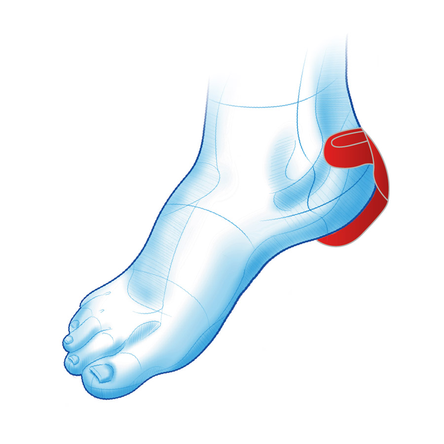Żelowa podpietka i zapiętka 2w1 HEEL PROTECTOR MS509 Żelowa podpietka i zapiętka 2w1 HEEL PROTECTOR MS509