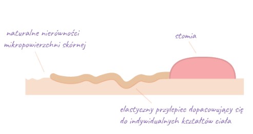 Worek urostomijny jednoczęściowy Aurega® 1