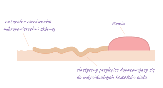 Kołnierzowa płytka stomijna Aurega® 2 Kołnierzowa płytka stomijna Aurega® 2