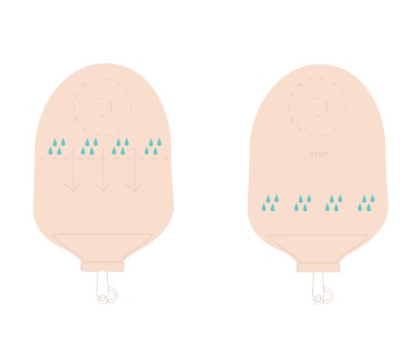 Worek urostomijny jednoczęściowy Aurega® 1 Convex Light Worek urostomijny jednoczęściowy Aurega® 1 Convex Light