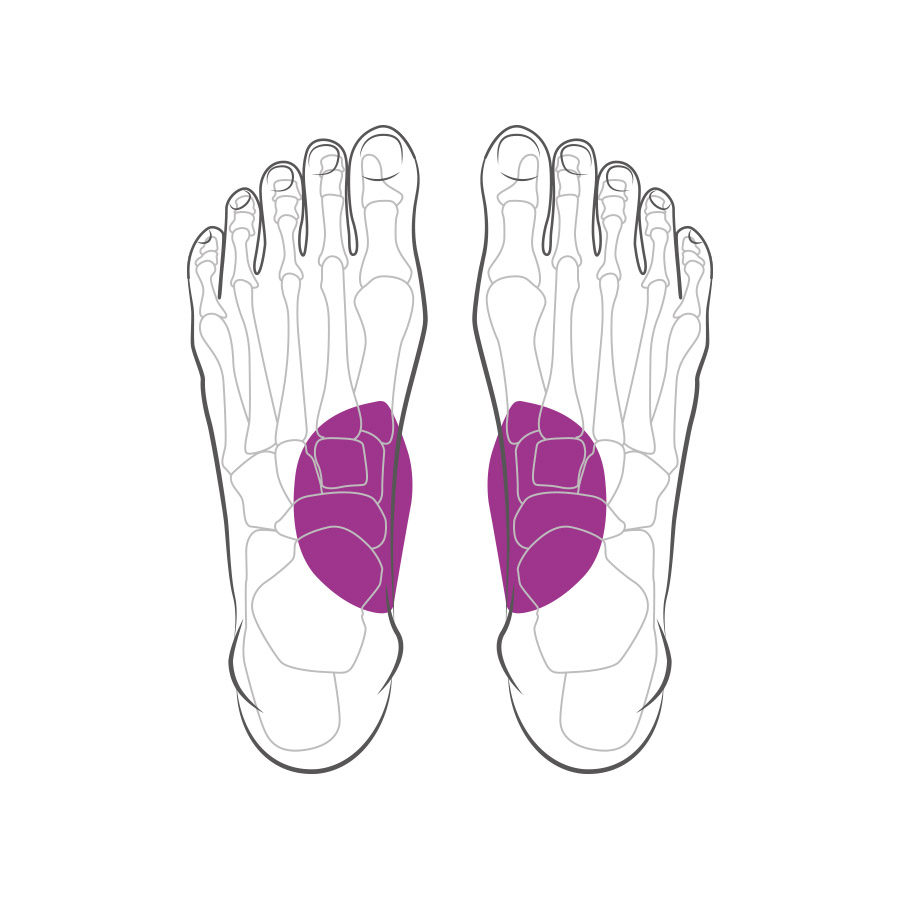 Klin podnoszący łuk podłużny stopy Klin podnoszący łuk podłużny stopy
